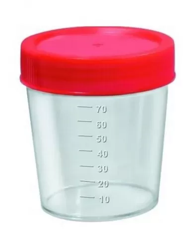 Coletor Universal de Urina 80ml com Tampa Vermelha – Estéril, Sem Pá